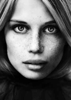 Freckles